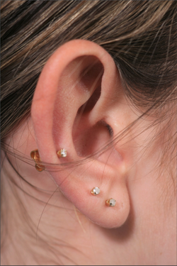 ear pin before 2